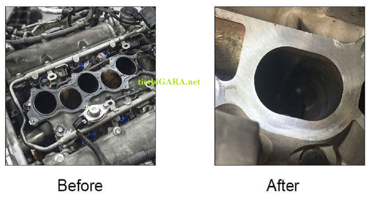 Trước và sau khi vệ sinh họng nạp